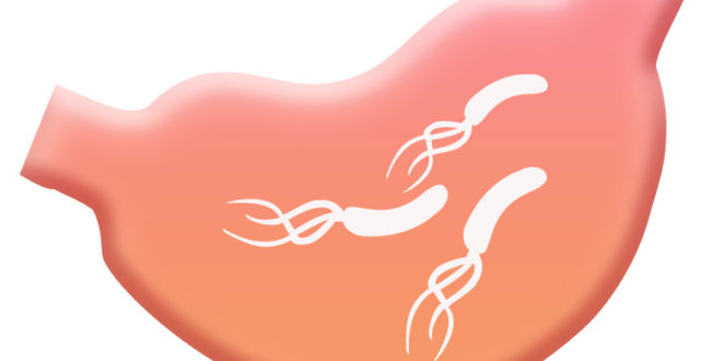 ピロリ菌　胃癌